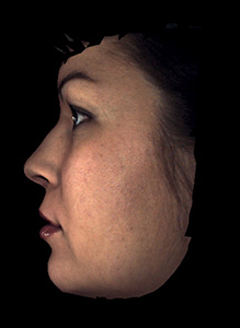 Pre and post-operative comparisons Pre and post-operative comparisons